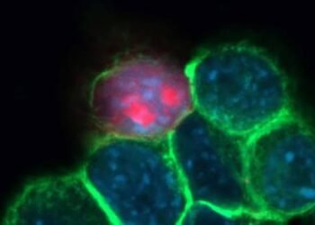 IISc Ultrasound Breakthrough Offers Hope for Oral Cancer Treatment