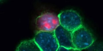 IISc Ultrasound Breakthrough Offers Hope for Oral Cancer Treatment