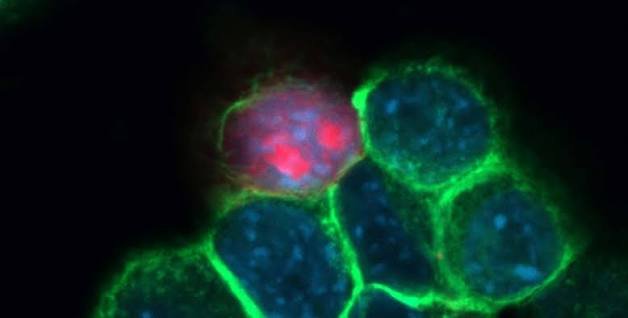 IISc Ultrasound Breakthrough Offers Hope for Oral Cancer Treatment